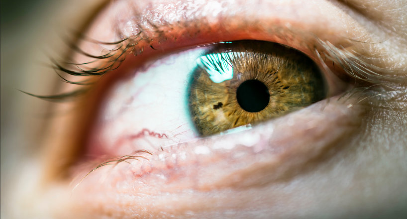 Causes of Pink Eye